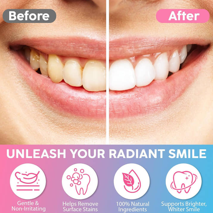 Niacinamide Teeth Brighten Toothpaste Plaque Stain Remover.