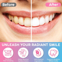 Niacinamide Teeth Brighten Toothpaste Plaque Stain Remover.